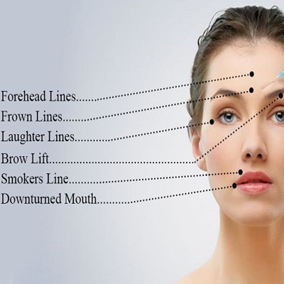 anti wrinkle injections in Cambridge at The Hidden Beauty Room